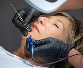 Elektrisch epileren van de kin vrouw