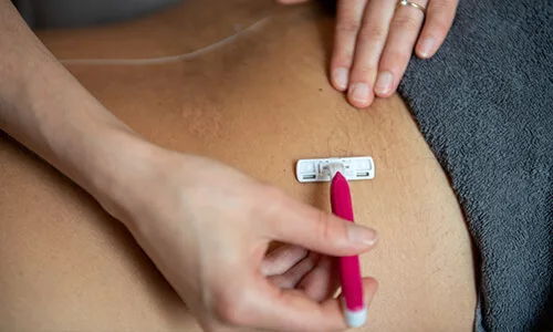 Scheren van de rug ter voorbereiding op een behandeling voor definitief ontharen