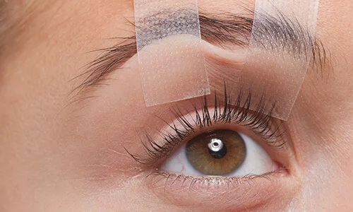 Hangende oogleden vervelend en zwaar aanvoelen