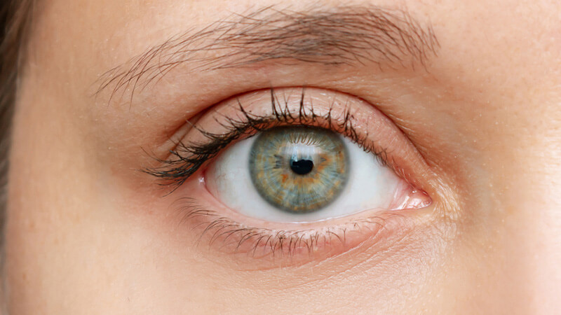 Hangende oogleden na een ooglidcorrectie zonder operatie