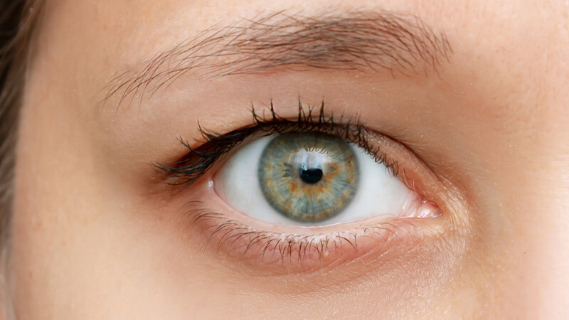 Hangende oogleden vooraf aan de ooglidcorrectie zonder operatie