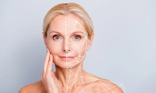 Slappe huid gezicht kun je laten verstrakken zonder te snijden