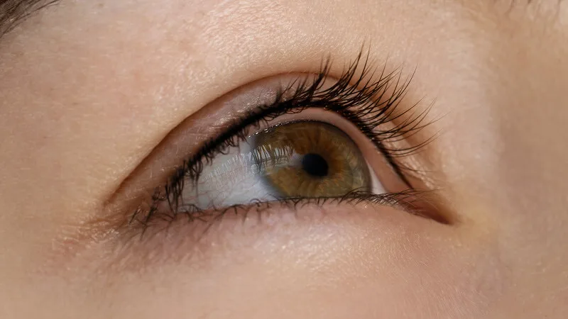Resultaat van een ooglid na een PMU eyeliner behandeling