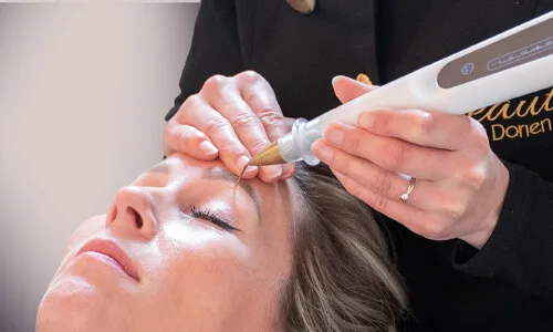 Ooglidcorrectie met plasma lift voor hangende oogleden